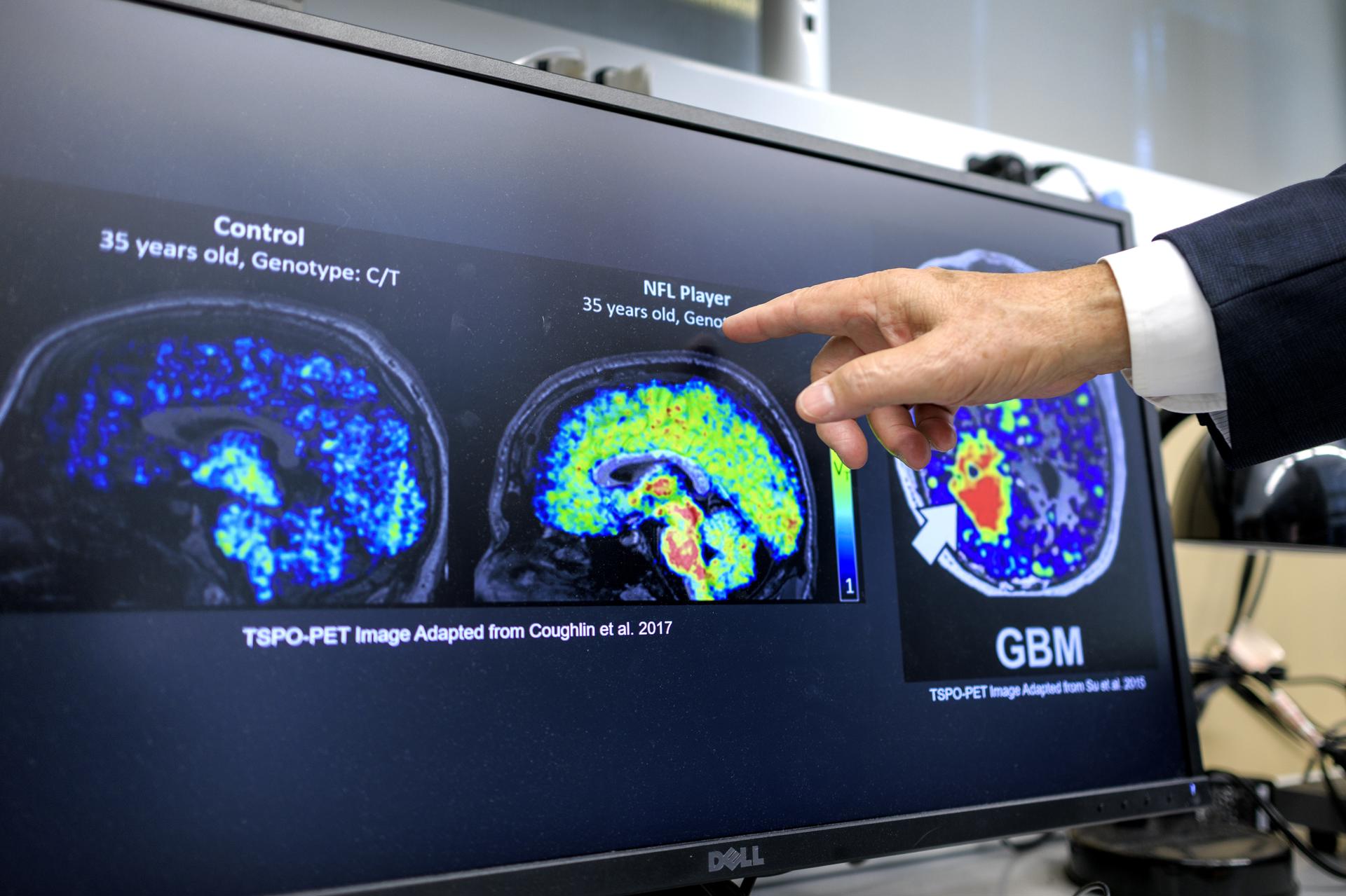 El decano de la Robert Stempel College of Public Health & Social Work de la Universidad Internacional de Florida, el doctor Tomas R. Guilarte, habla sobre las imágenes de autorradiografía cuantitativa mostradas en una pantalla, en su laboratorio en la Universidad Internacional de Florida, en Miami (FL, EE.UU.). EFE/Cristóbal Herrera