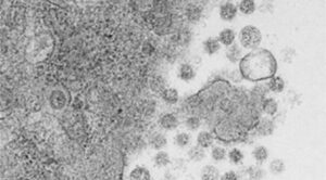 Virus del SARS-CoV-2 saliendo de las células infectadas. Equipo de Luis Enjuanes_PNAS
