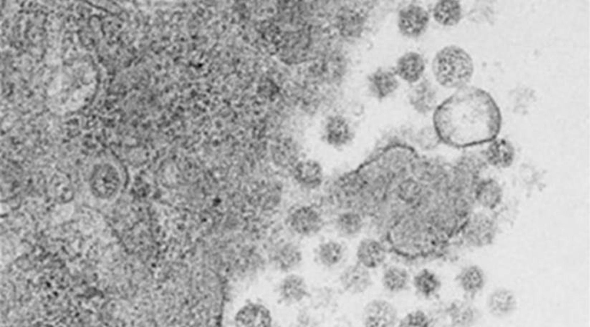 Virus del SARS-CoV-2 saliendo de las células infectadas. Equipo de Luis Enjuanes_PNAS