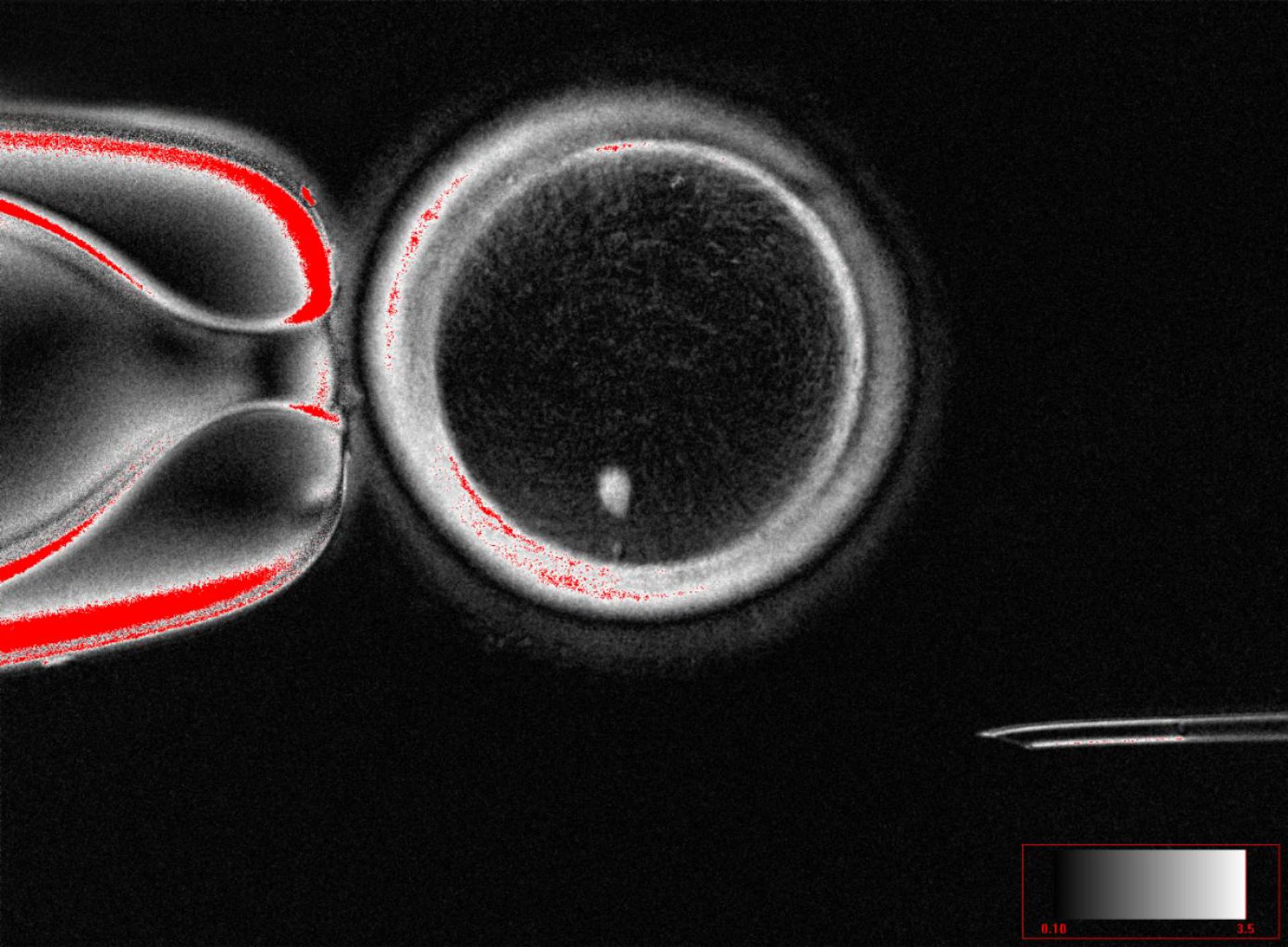 Ovocito humano con transferencia nuclear de células somáticas con huso visible (punto brillante en el interior) antes de la fecundación. Crédito: Mitalipov laboratory