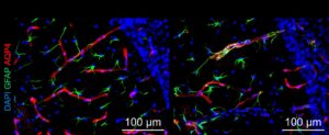En comparación con los animales control (izquierda), los tratados con la cepa inducida por la contaminación (derecha) presentan estructuras celulares anormales en las regiones cerebrales relacionadas con la demencia. XIAODI ZHANG. Imagen facilitada por la Johns Hopkins Medicine.