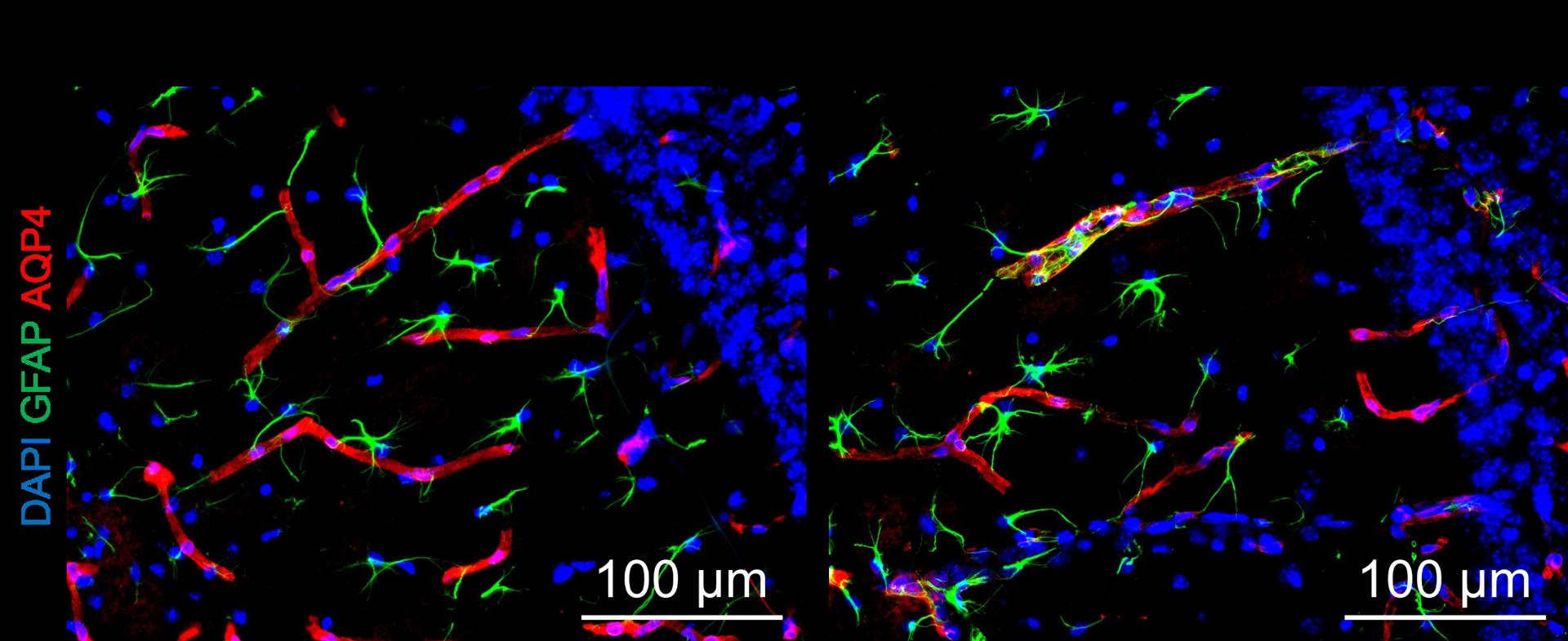 En comparación con los animales control (izquierda), los tratados con la cepa inducida por la contaminación (derecha) presentan estructuras celulares anormales en las regiones cerebrales relacionadas con la demencia. XIAODI ZHANG. Imagen facilitada por la Johns Hopkins Medicine.