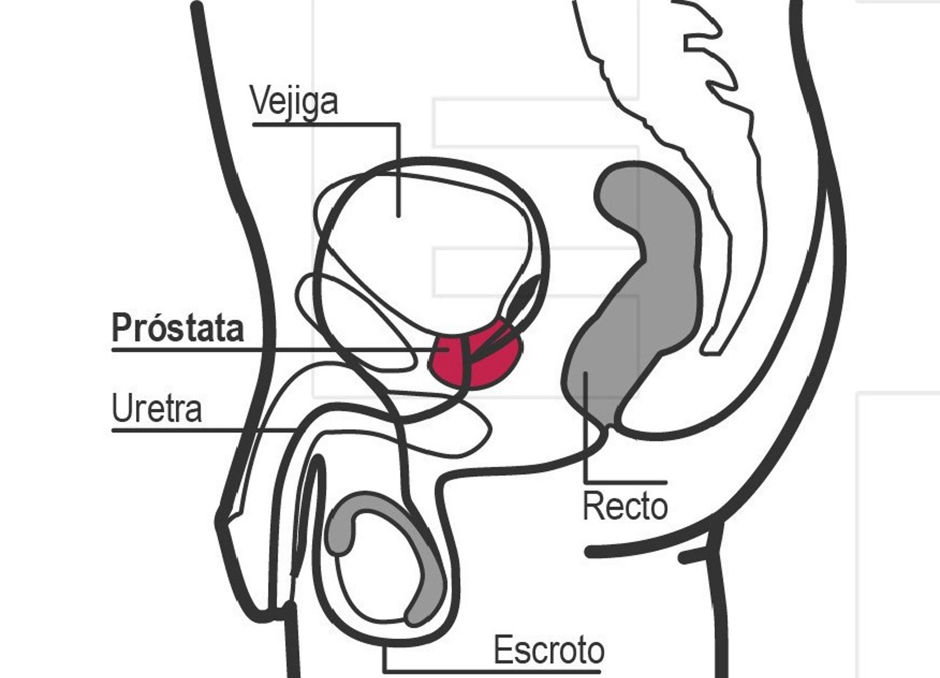 Los diagnósticos de cáncer de próstata aumentaron un 3 % anual entre 2014 y 2021 en EE.UU., según el informe anual de la ACS. Detalle de una infografía de la Agencia EFE acerca del Cáncer de próstata. EFE