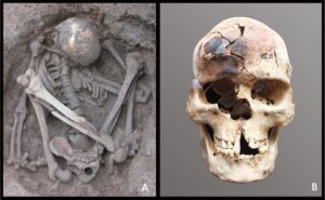 Individuo joven de sexo masculino en posición hiperflexionada (izquierda) procedente del yacimiento de Liyupo, en Guangxi (China), de hace unos 7.000 años, con el cráneo parcialmente quemado (derecha). Crédito: Zhen Li and Hirofumi Matsumura/Imagen cedida por la PNAS