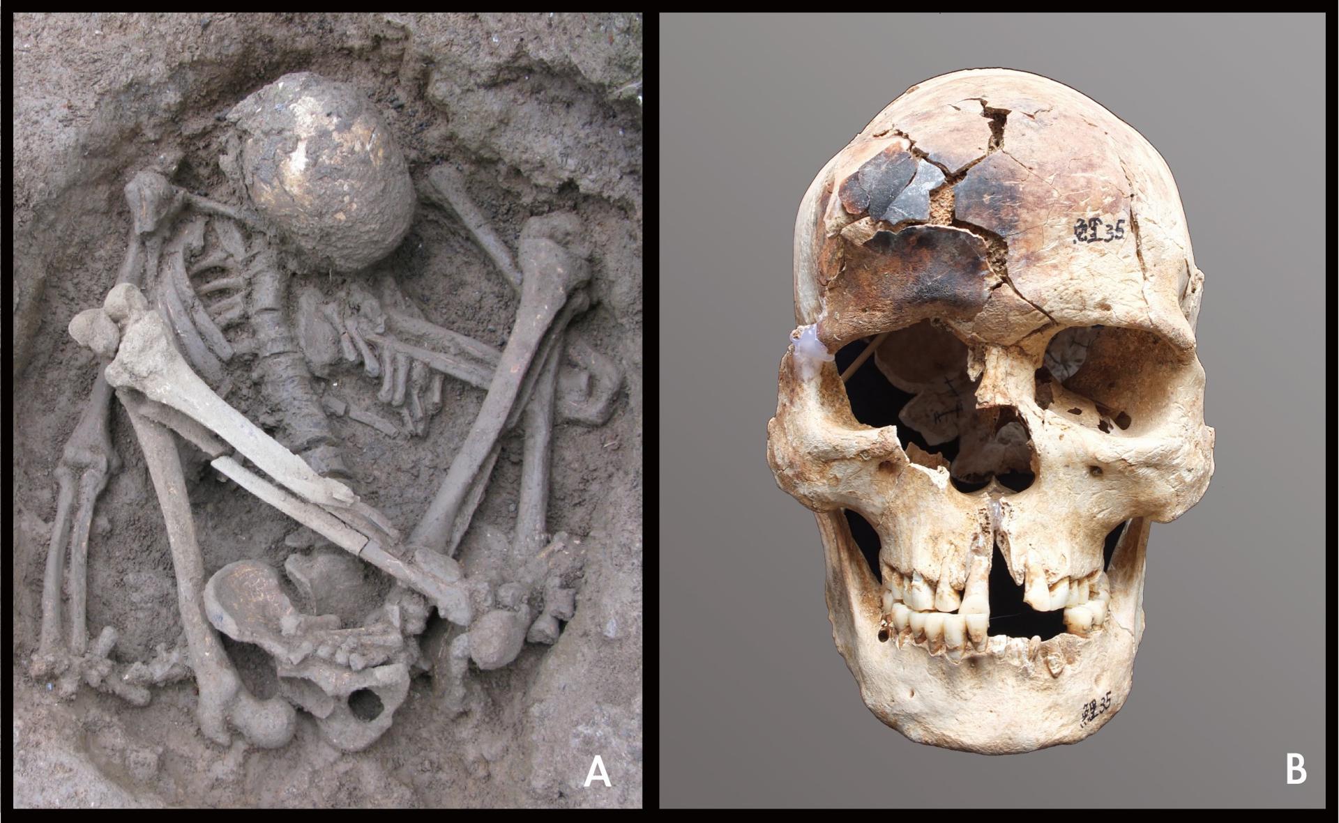 Individuo joven de sexo masculino en posición hiperflexionada (izquierda) procedente del yacimiento de Liyupo, en Guangxi (China), de hace unos 7.000 años, con el cráneo parcialmente quemado (derecha). Crédito: Zhen Li and Hirofumi Matsumura/Imagen cedida por la PNAS