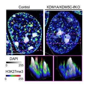 Investigadores del Instituto de Neurociencias han identificado dos enzimas que colaboran para evitar que las neuronas activen genes inadecuados, lo que garantiza su correcto funcionamiento, un hallazgo que abre nuevas vías para comprender el origen de trastornos neurológicos asociados a mutaciones en estos genes, como la discapacidad intelectual. Las neuronas son células altamente especializadas y su correcto funcionamiento depende de que conserven su identidad a lo largo de toda la vida. -EFE/Instituto de Neurociencias ***SOLO USO EDITORIAL/SOLO DISPONIBLE PARA ILUSTRAR LA NOTICIA QUE ACOMPAÑA (CRÉDITO OBLIGATORIO)***