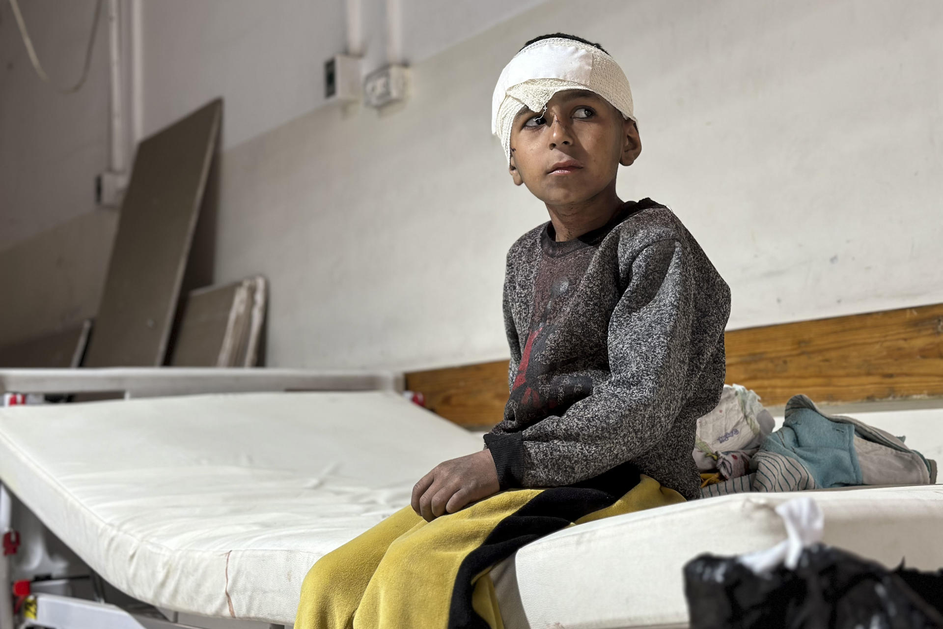 Un niño que resultó herido en un bombardeo del ejército israelí, descansa tras ser atendido en el hospital indonesio en la localidad de Beit Lahia, el 20 de marzo de 2025.  EFE/ Ahmad Awad