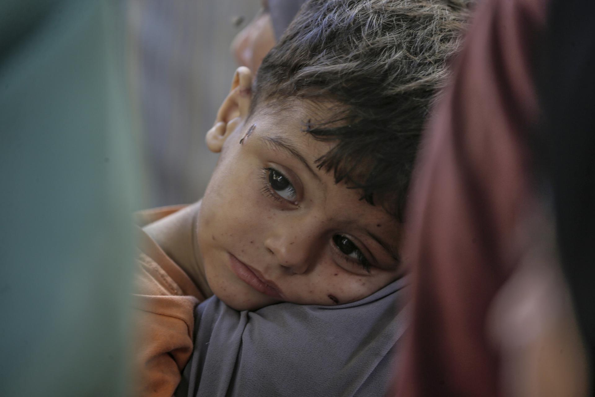 Imagen de un niño en el Hospital Al Shifa en Gaza, el 3 de septiembre de 2025. EFE/EPA/MOHAMMED SABER