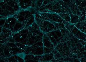 Imagen de microscopía con neuronas teñidas con marcadores estudiados en este trabajo. Imagen: Francisco Javier Díez Guerra/Centro de Biología Molecular (CBM) Severo Ochoa