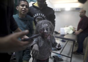 Imagen de archivo de una niña herida en ataques aéreos israelíes sobre el sur de Gaza. EFE/EPA/HAITHAM IMAD