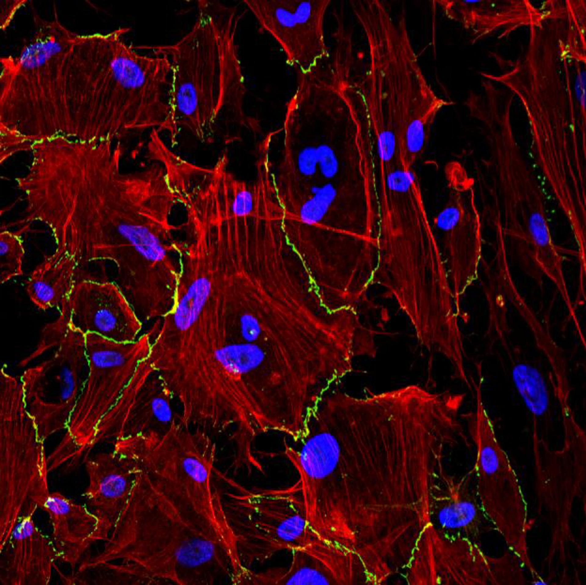 Células mesoteliales del peritoneo observadas por microscopía confocal. En azul, los núcleos, en rojo, el esqueleto celular y en verde, la proteína de membrana ZO-1. Crédito: Pilar Sandoval, CBM.