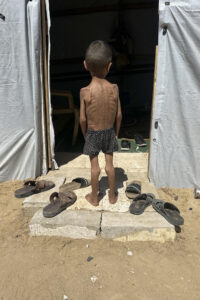 El niño gazatí Osama al Raqab, de 5 años, el 21 de abril de 2025. EFE/ Ahmad Awad