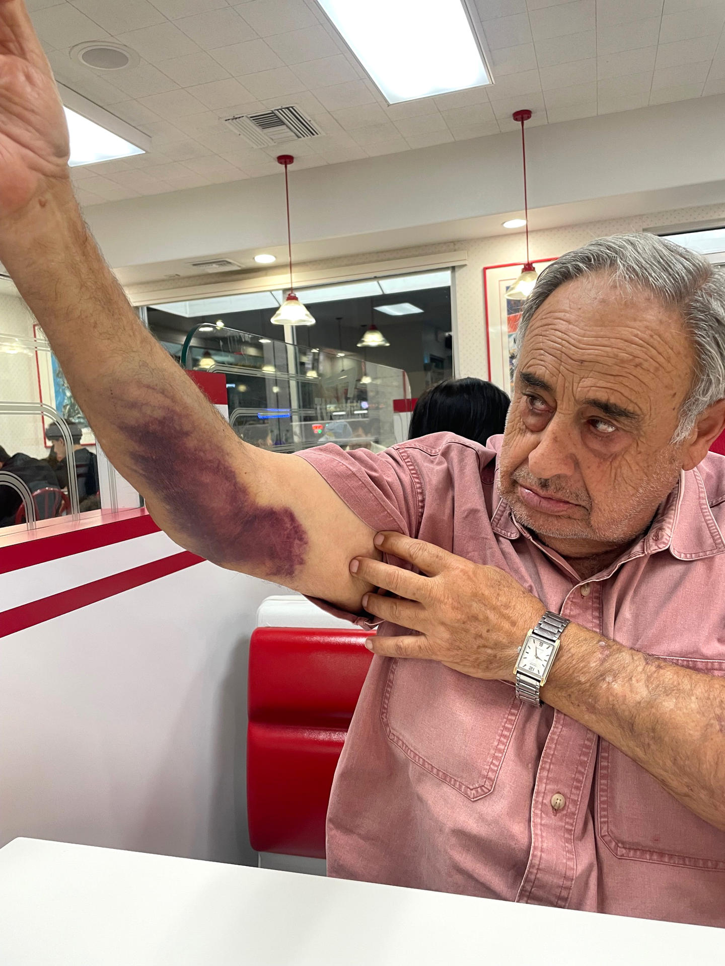 Fotografía sin fecha específica de toma cedida por los abogados de la familia Shouhed donde aparece Rafie Ollah Shouhed, de 79 años y dueño de un lavadero de autos en Los Ángeles, mostrando las lesiones y golpes recibidos durante su detención en una redada migratoria el 9 de septiembre de 2025. EFE/Familia Shouhed
