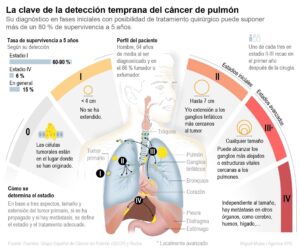Infografía realizada por la agencia EFE basada en datos suministrados por el Grupo Español de Cáncer de Pulmón (GECP) y Roche Farma que muestra la clave en la detección temprana del cáncer de pulmón. EFE/ Miguel Mulas